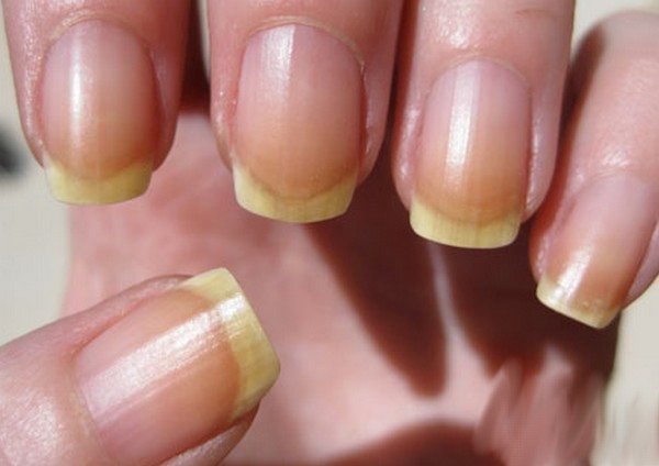 Yellow Nails Warning Sign 